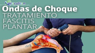 ONDAS DE CHOQUE  TRATAMIENTO FASCITIS PLANTAR con ESPOLON CALCANEO Fisioterapia  Fisiolution [upl. by Lehar]