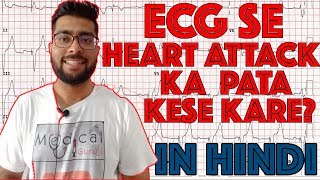 ECG reading in Hindi Language part 2  How to read ECG signal part 2  Medical Guruji [upl. by Galen]