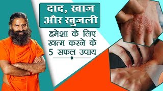 दाद खाज खुजली हमेशा के लिए खत्म करने के 5 सफल उपाय  Swami Ramdev [upl. by Ludmilla]