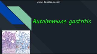 Autoimmune gastritis [upl. by Ina]