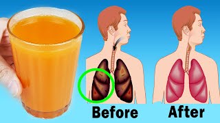 Remedy For Cleaning Lungs  Remove Mucus From Your Lungs And Improve Respiratory [upl. by Shewchuk]