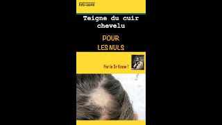 Teigne du cuir chevelu pour les nuls [upl. by Akimas]