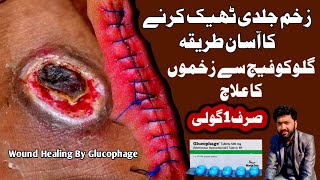 Dr Saif Ur Rehman  Can Metformin Help Your Wounds Heal Faster [upl. by Munshi398]