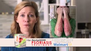 Psoriasis Cream  Dr Blaines RevitaDERM Psoriasis Treatment [upl. by Iblehs446]