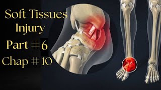 Soft tissues Injuries  Part6  Chapter10 Therapeutics [upl. by Corwin]