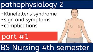 Klinefelter Syndrome  Karyotype Symptoms and Diagnosis pathophysiology 2 in Urdu and Hindi [upl. by Goldberg]