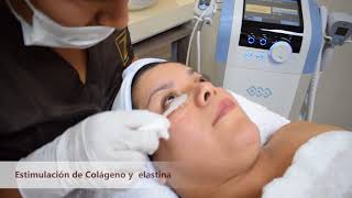 Rejuvenecimiento Facial  Exilis Ultra [upl. by Adnaval367]