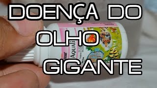 DOENÇA DO OLHO GIGANTE [upl. by Kcirdled]