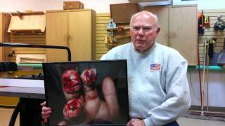 SawStop  Craig B describes his table saw injury [upl. by Peg]