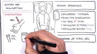 Diabetic Ketoacidosis Diabetes Type I Management Summary [upl. by Roosevelt]