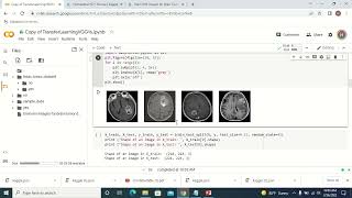 Deeplearning in Health care  Image Classification usingVGG16 [upl. by Ahcrop]