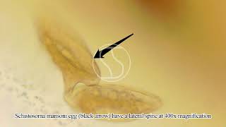 Schistosoma mansoni Egg under the microscope [upl. by Brownley86]