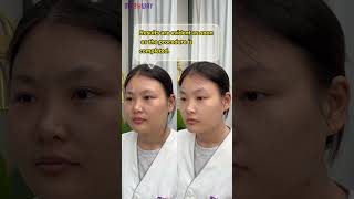 Notice pigmentation lightening in just weeks 🌞💧 hydradermabrasion skinrejuvenation mychway [upl. by Gnahk]