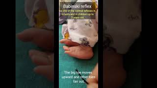 Babinski Reflex in newborn [upl. by Fortunio]