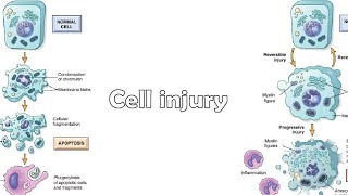 Mechanisms of cell injury [upl. by Alleras]