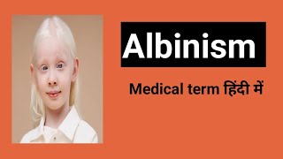 AlbinismMedical term in hindi [upl. by Tessil460]