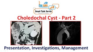 Choledochal cyst Part 2  clinical presentation investigations and management  Edusurg Clinics [upl. by Ccasi]