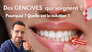 Explication GENCIVE qui SAIGNE  la solution [upl. by Silvestro]