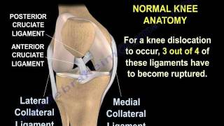 Knee Dislocations  Everything You Need To Know  Dr Nabil Ebraheim [upl. by Relyhs565]