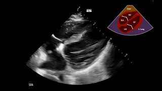 Cardiogenic Shock Case 2 Part 1  Interpretation Challenge [upl. by Ahsinnod149]