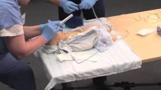 Using a Meconium Aspirator [upl. by Euqinahc9]