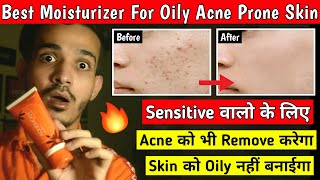 Best Moisturizer For Acne Prone Skin  Acne Prone Skin Ke Liye Best Moisturizer [upl. by Eveleen323]