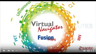 Virtual Navigator amp fusion imaging  Clinical Cases [upl. by Reidid]