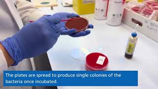 Microbiology  Blood culture [upl. by Leumek]