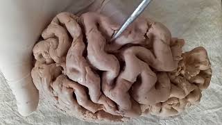 NEUROANATOMY  CEREBRAL CORTEX PART1 SULCI AND GYRI  BY DR MITESH DAVE [upl. by Tate454]