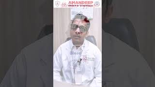 Brain Stroke Explained in 60 Seconds by Dr Sumit Gupta 🧠 [upl. by Noslien]