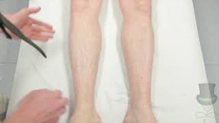 Assessment of the legs for deep vein thrombosis [upl. by Goodyear758]