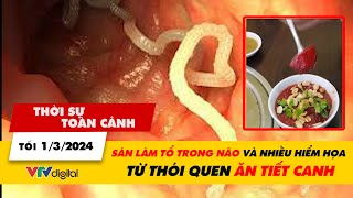 Thời sự toàn cảnh Tối 13 Sán làm tổ trong não và nhiều hiểm họa từ thói quen ăn tiết canh  VTV24 [upl. by Lonnard526]