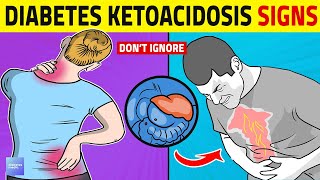 Diabetic Ketoacidosis Warning Signs You Should Know [upl. by Avilo]