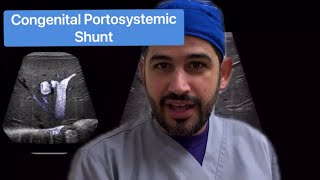 Congenital Portosystemic Shunt [upl. by Pogue]