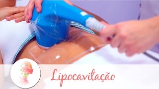 Lipocavitação tratamento estético reduz gordura localizada [upl. by Delp]