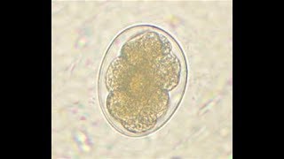 Parasitology 200 b Hookwormancylostoma duodenalelife cycleeggadultrhabdiformfilariform larva [upl. by Dotty114]