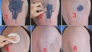 How to Remove a Tattoo without Laser at Home [upl. by Atinev]