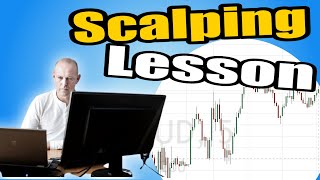 Scalping lesson [upl. by Alexandria]