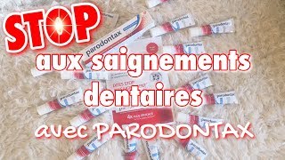 Je teste le dentifrice Parodontax [upl. by Yeniar983]