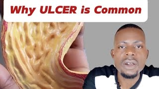 How we spread Ulcer everyday [upl. by Swords685]