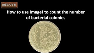 How to use ImageJ software to count the number of bacterial colonies [upl. by Whetstone130]