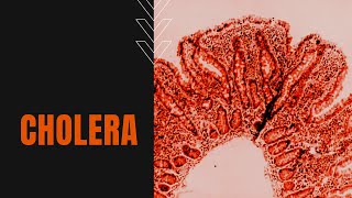 What is Cholera Causes Symptoms Transmission and Treatment [upl. by Nancie]