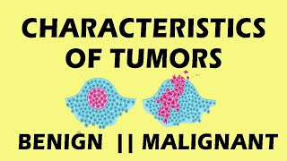 Characteristics Of Tumor Pathology  Characteristics Of Tumor Cells medicine pathology [upl. by Odlanier953]