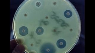 Antibiotic Producing Bacteria  Microbiology [upl. by Naitsabas]