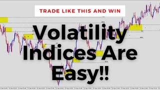 How To Trade Volatility Indices Institutional Trading Strategies [upl. by Nim]