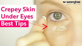 Crepey Skin Under The Eyes Top Tips To Help [upl. by Fisken234]