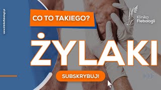 Żylaki  co to takiego [upl. by Eulaliah84]