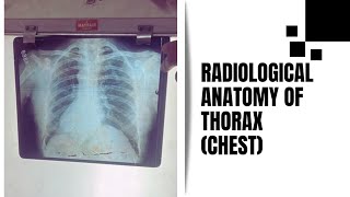 Radiological Anatomy  Xray Chest  Anatomy practicals and viva  For 1st year MBBS [upl. by Dranyam]