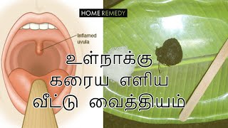 Natural Remedies For Swollen Uvula  Continuous Cough  உள்நாக்கு கரைய எளிய வீட்டு வைத்தியம் [upl. by Lari571]