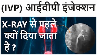 Intravenous Pyelogram in Hindi  Intravenous Pyelogram Procedure  IVP Test for Kidney [upl. by Dale284]